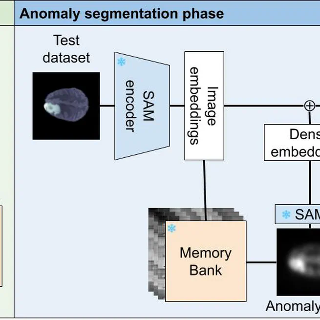 MIAS-SAM: Medical Image Anomaly Segmentation without thresholding