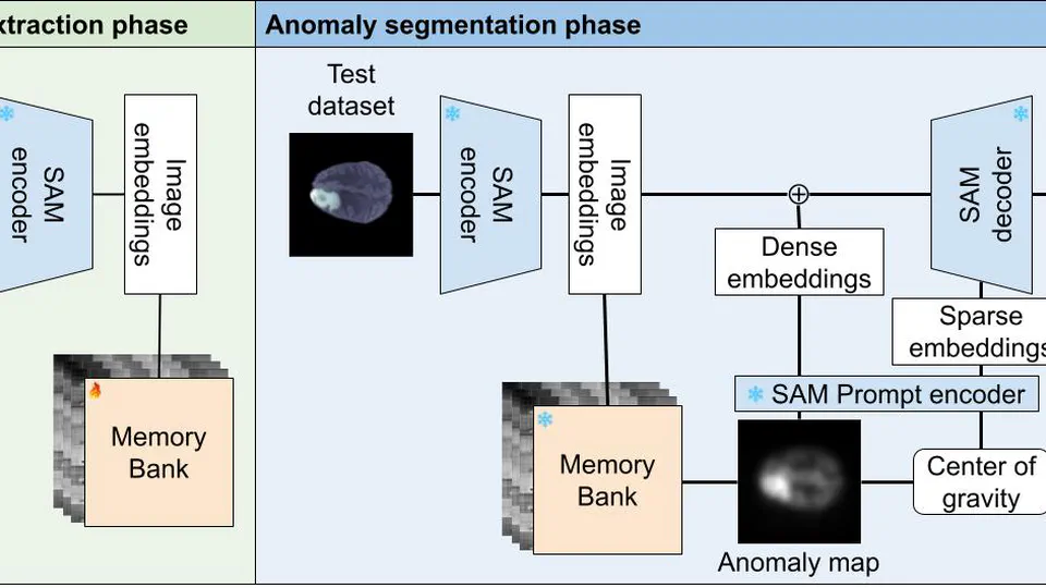 MIAS-SAM: Medical Image Anomaly Segmentation without thresholding